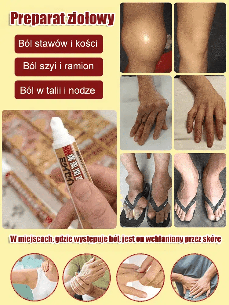 Medicinski gel za zglobove za giht. Ne trpite napade gihta! Ovaj gel se brzo upija, djeluje za 10 minuta i ublažava oteklinu i bol!
